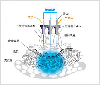 lp02-point-image02